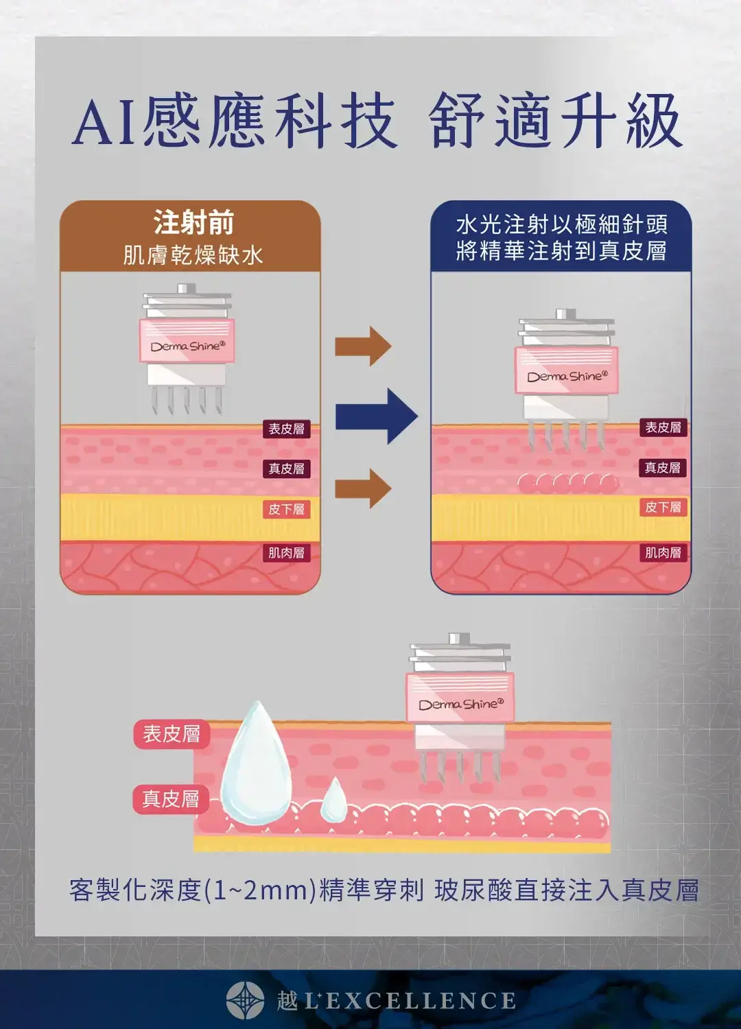 DermaShine 德瑪莎肌膚之光 水光針 水光槍 水光針效果 保濕 緊緻 越診所 Mb04