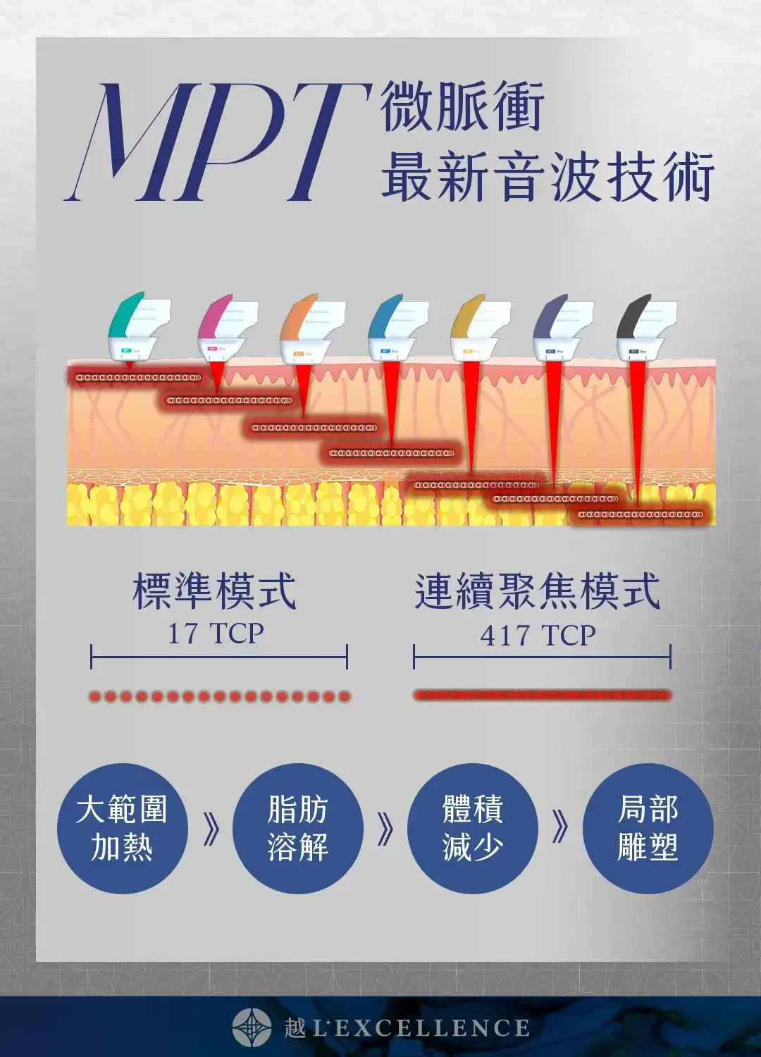 Ultraformer MPT 海芙音波 媚必提 媚必提眼周 音波拉提 越診所 Mb03