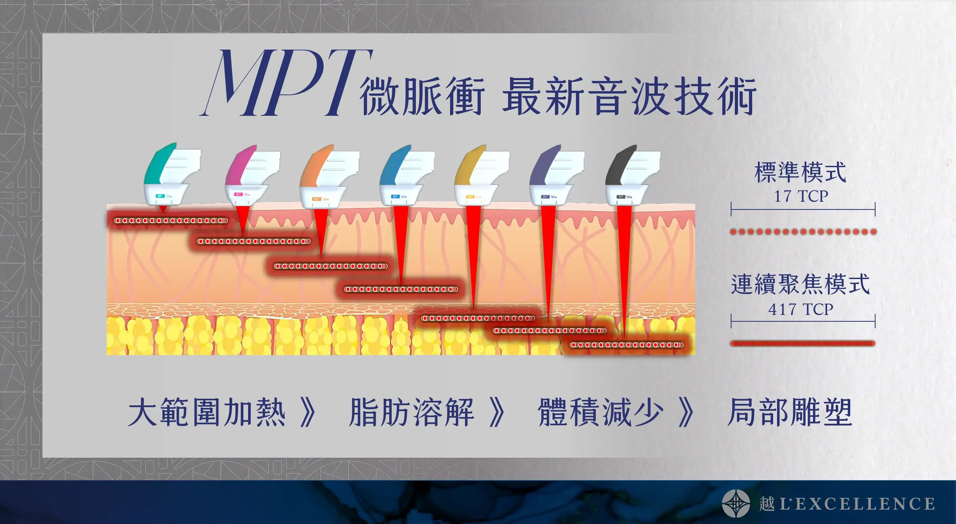 Ultraformer MPT 海芙音波 媚必提 媚必提眼周 音波拉提 越診所03