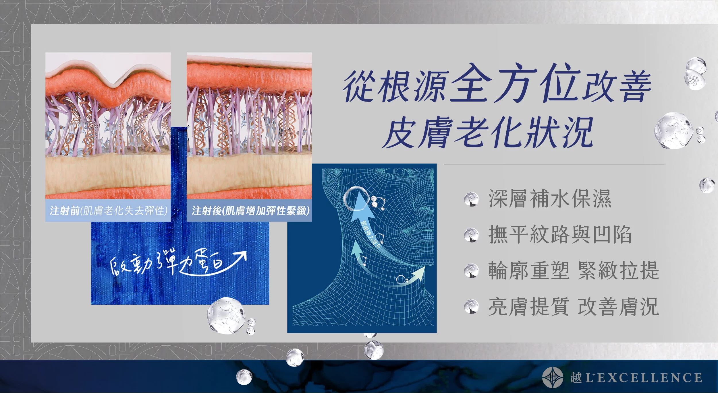 逆時針 Profhilo 璞菲洛 液態電波 玻尿酸 彈力蛋白 脖紋 頸紋 越診所03